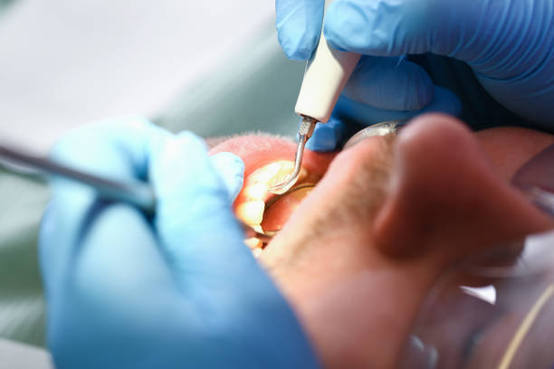 Best Emergency Denture Repair in New Lebanon, OH