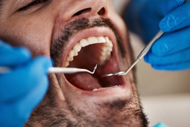 Best Broken or Chipped Tooth Repair in New Lebanon, OH